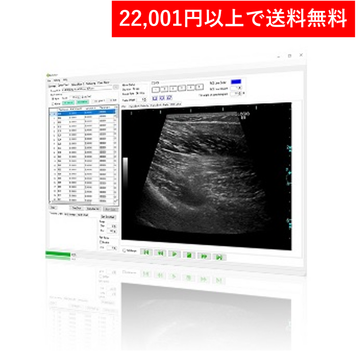 ＜ソフトウエア＞Echolizer – GLAB.ショップ